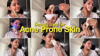 Skincare Tips For Acne Prone Skin  Skincare Routine For Pimples and Acne [upl. by Si]