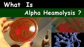 What is Alpha haemolysis Pattern [upl. by Yolanthe828]