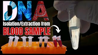 DNA Extraction from Blood Samples Comprehensive StepbyStep Guide  Molecular Biology Laboratory [upl. by Asusej]