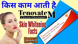 Tenovate M Skin Cream Ke Fayde  Clobetasol amp Miconazole Ointment For Fungal Infection In Hindi [upl. by Magdalen]