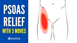 3 Moves to Release a Tight Psoas HIP FLEXORS [upl. by Aggy806]