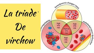 🔴la triade de VIRCHOW ET LA THROMBOSE VEINEUSE PROFONDE [upl. by Kawai777]