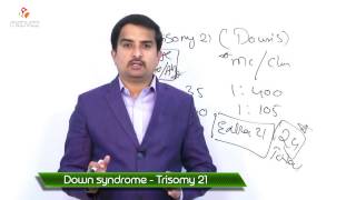 Downs syndrome  Trisomy 21  Usmle quick review [upl. by Pare]