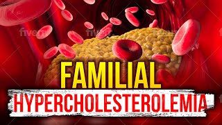 Familial Hypercholesterolemia Explained [upl. by Notyard488]