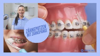 Zähneputzen mit Brackets  Unsere Tipps um die Zahnspange richtig sauber zu bekommen [upl. by Marucci]