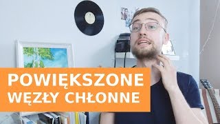 POWIĘKSZONE WĘZŁY CHŁONNE Kiedy mogą być nowotworowe Onkologia Kliniczna [upl. by Nosna894]