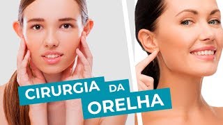 Cirurgia para corrigir a orelha em abano Tudo sobre otoplastia com Dr Lecy Marcondes [upl. by Nniroc]