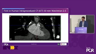 The future of interventional cardiology imaging  EuroPCR 2024 [upl. by Atil793]