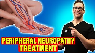 Peripheral Neuropathy Treatment Leg amp Foot Nerve Pain HOME REMEDIES [upl. by Nyrem]