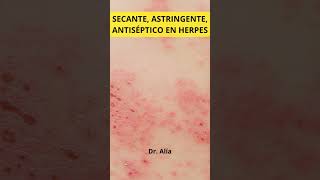 Solución sulfato de zinc para herpessulfatodezinc herpes [upl. by Faydra863]