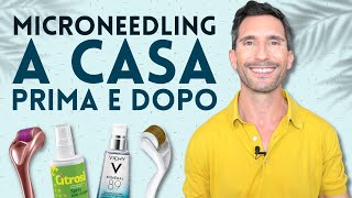 MICRONEEDLING A CASA PRIMA E DOPO [upl. by Kerwin37]