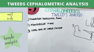 tweeds cephalometric analysis  orthodontics lecture notes [upl. by Leonanie]