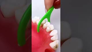 Best tool for teeth shortsvideo [upl. by Brackely577]