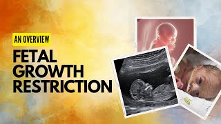 Fetal Growth Restriction IUGR  Exam Case Discussion Overview [upl. by Akemaj]