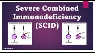 Severe Combined Immunodeficiency SCID  Immunology USMLE Step 1 [upl. by Narcho]