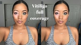 VITILIGO FULL COVERAGE  GREEN SMOKEY EYE [upl. by Noir793]