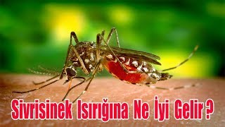 SİVRİSİNEK ISIRIĞINA NE İYİ GELİR  SİVRİSİNEK ISIRMASI  SİVRİSİNEK ISIRIĞI NASIL GEÇER [upl. by Placia652]