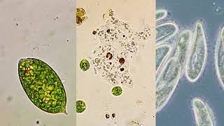 Microorganism moving methods  Flagella Pseudopodia and Cilia [upl. by Oinolopa]