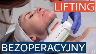 Bezoperacyjny lifting twarzy i ciała  HIFU Ultraskin II Absolute [upl. by Cila834]