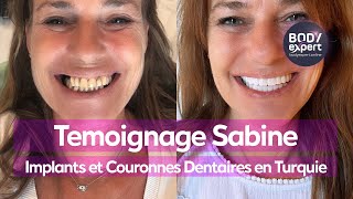 SOINS DENTAIRES  🦷 Témoignage Sabine  8 implants  22 couronnes dentaires Emax  BODYEXPERT [upl. by Bakki]