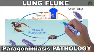 Paragonimiasis  Lung fluke and its Life Cycle [upl. by Llekcir]