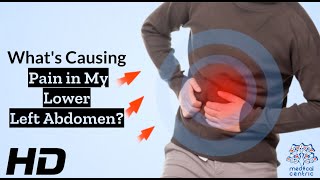 Abdominal Ailments Common Triggers of Lower Left Pain Explained [upl. by Esereht460]