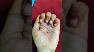 White Lunula Signs in Hand palmistryastrology palmistry shortvideo ytshorts [upl. by Kowtko]