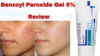 Benzoyl Peroxide Gel For Acne Treatment Review In Hindi 2019 [upl. by Margarida507]