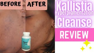 Kallistia Hyperpigmentation Cleanse Supplements REVIEW skincare [upl. by Lole]