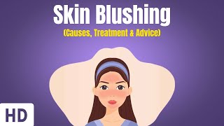 Skin Flushing or Blushing Everything You Need To Know [upl. by Alarise]