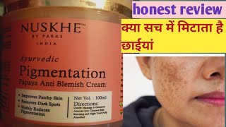 Nushke by Paras pigmentation cream review nuskhebyparas  pigmentation cream [upl. by Eiclud]