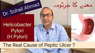 Helicobacter Pylori  The Cause of Peptic Ulcers Gastric amp Duodenal Ulcers  Urdu  Hindi [upl. by Yme466]