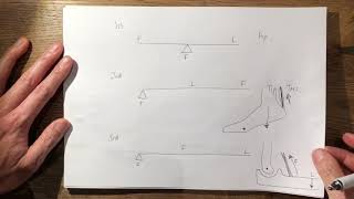 23 Free Body Diagram Principles FRCS TrampOrth [upl. by Edson]