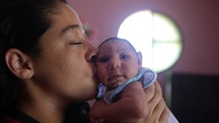 US CDC concludes Zika causes microcephaly other birth defects [upl. by Zindman]