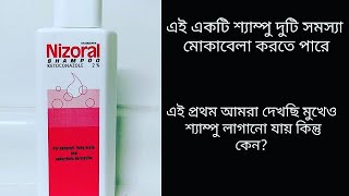 Nizoral shampoo review in bangla Nizoral shampoo কিভাবে চেহারা র fungal acne কমায় জেনে নিন [upl. by Liagabba854]