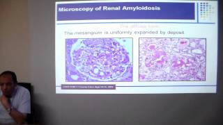 FMF and renal amyloidosis prof Ayman Refaie Mansoura UNC [upl. by Ozzy]