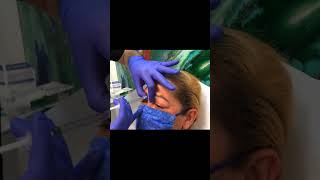 11 Lines Botox  Botox Injection For Glabella And Forehead shorts [upl. by Atnuahs92]