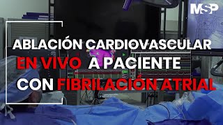 Ablación Cardiovascular en vivo a paciente con Fibrilación atrial  ExclusivoMSP [upl. by Elrebmik]