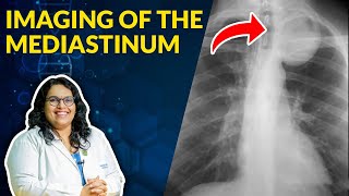 Imaging of Mediastinum Radiological Anatomy  Dr Avni Skandhan MD [upl. by Palermo]