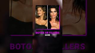 Dr Praharsh Devraj explains fillers and botox gone wrong bangalore fillers botox botoxfillers [upl. by Heti]