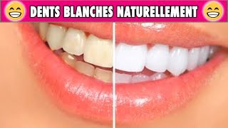 BLANCHIMENT des dents CHEZ SOI  la méthode EFFICACE et NATURELLE [upl. by Outlaw344]