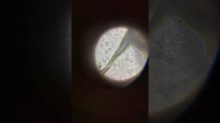 In this video we observe bacteria moving live under a microscope See the world of bacteria [upl. by Aicatsanna]