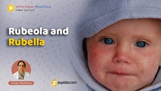 Rubeola and Rubella Preview Infectious Medicine sqadiacom [upl. by Lette]