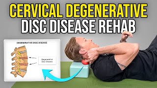 4 Exercises for Cervical Degenerative Disc Disease [upl. by Pellikka24]