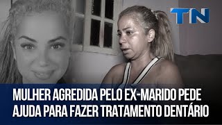 Mulher agredida pelo exmarido pede ajuda para fazer tratamento dentário [upl. by Tama896]