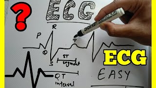 How to Read ECG in Hindi easy wayECG reading in Hindi ECG interpretation make easy ECG [upl. by Chevalier]