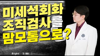 미세석회화 조직검사 맘모톰으로 가능합니다 [upl. by Aramanta]