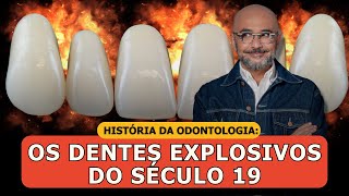 História da Odontologia A Curiosa História dos Dentes Explosivos [upl. by Faires]