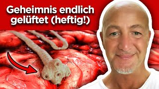 Geheimrezept enthüllt Parasiten sofort loswerden [upl. by Ecinna]