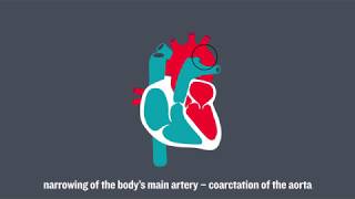 Congenital Heart Conditions [upl. by Llenyaj317]